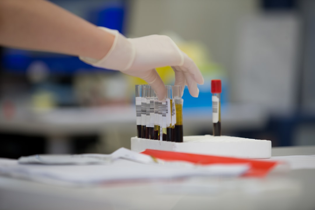 cortisol level blood test
